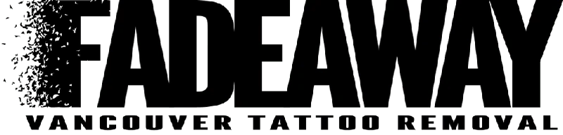 Fadeaway Vancouver Laser Tattoo Removal logo