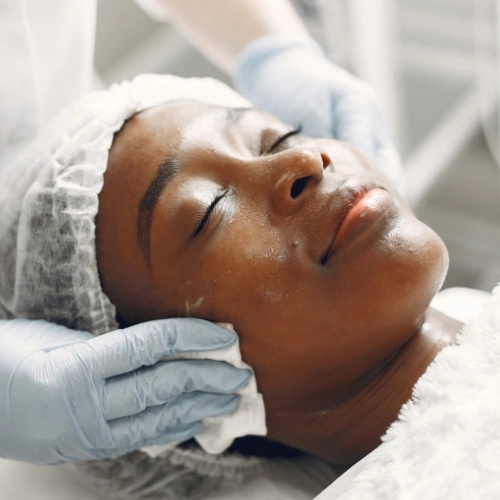 Acne facial hero image