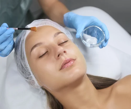 Chemical peel benefits guide hero image