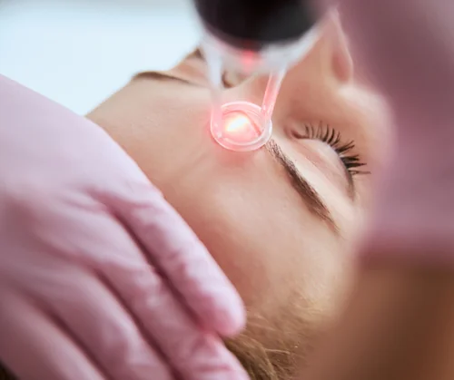 CO2 laser cost guide hero image