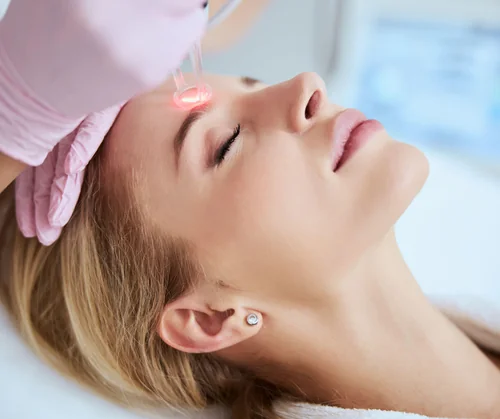 CO2 laser downtime hero image