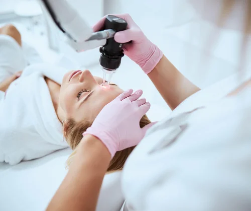 Full face CO2 laser resurfacing hero image