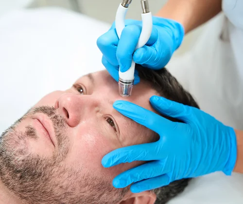 What is CO2 laser hero image