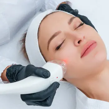 CO2 laser treatment inspiration