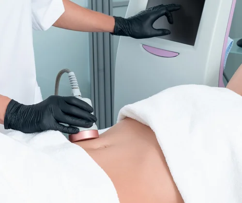 What is Emsculpt guide hero image