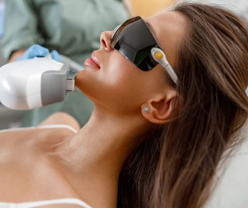 What to expect after IPL photofacial guide hero image