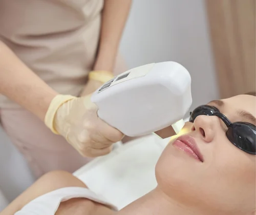 IPL photofacial cost guide hero image