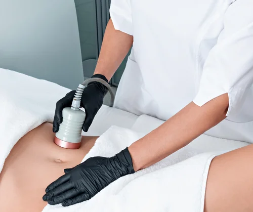 Is CoolSculpting safe guide hero image