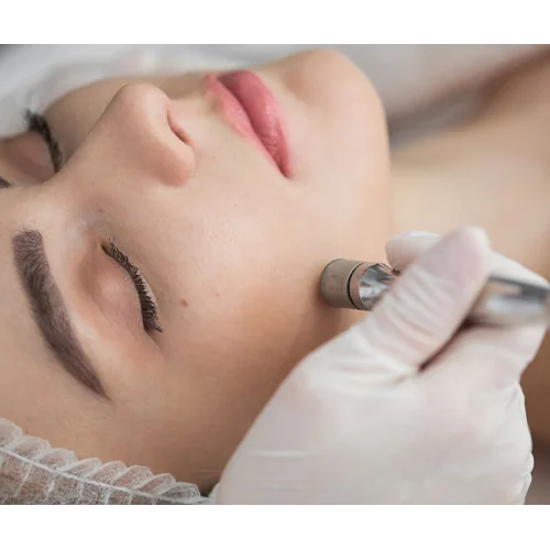 Microdermabrasion cost guide hero image