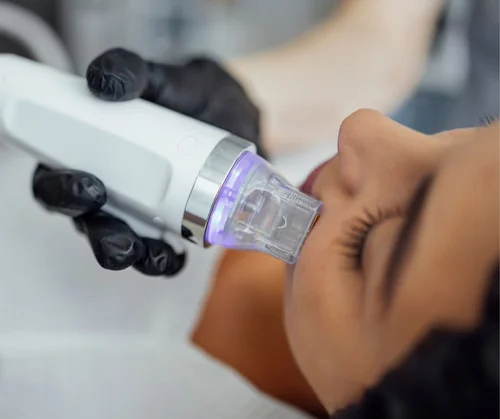 Microneedling cost guide hero image